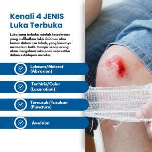 Kenali Jenis-jenis Luka Terbuka