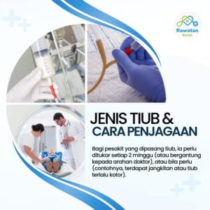 Jenis Tiub Dan Cara Penjagaannya