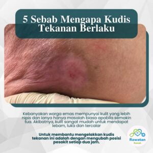 5 Sebab Mengapa Kudis Tekanan Berlaku