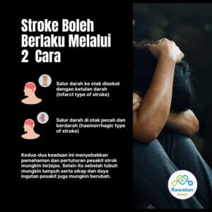 Strok Boleh Berlaku Melalui 2 Cara
