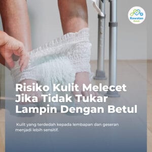 Risiko Kulit Melecet Jika Tidak Tukar Lampin Dengan Betul