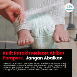 Kulit Pesakit Melecet Akibat Pampers, Jangan Abaikan