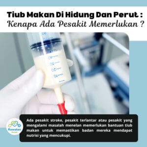 Tiub Makan Di Hidung Dan Perut : Kenapa Ada Pesakit Memerlukannya ?