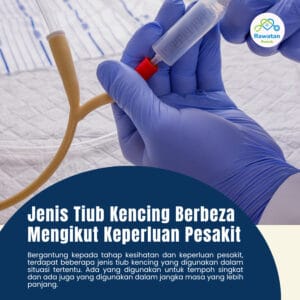 Jenis Tiub Kencing Berbeza Mengikut Keperluan Pesakit