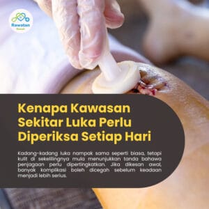 Kenapa Kawasan Sekitar Luka Perlu Diperiksa Setiap Hari ?