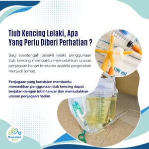Tiub Kencing Lelaki : Apa Yang Perlu Diberi Perhatian ?