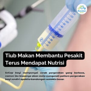 Tiub Makan Membantu Pesakit Terus Mendapat Nutrisi